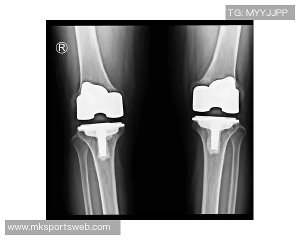 尤文图斯官方宣布卡巴尔右大腿肌肉受伤需两周后复查恢复情况